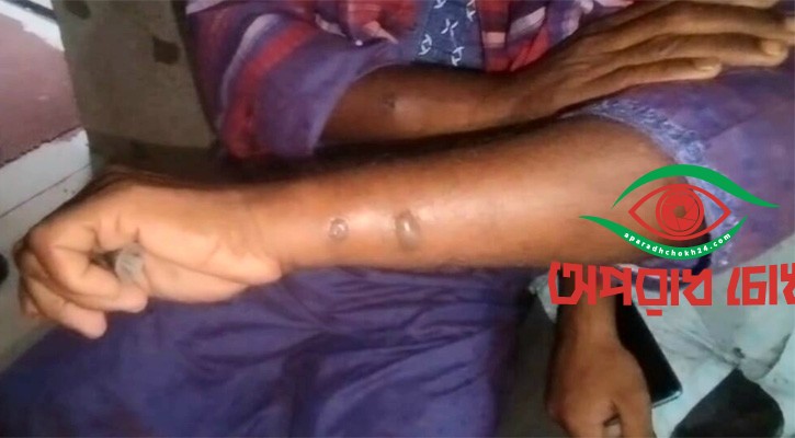 ১১ জনের শরীরে অ্যানথ্রাক্সের উপসর্গ