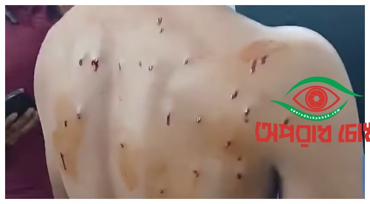 বেগমগঞ্জে গায়ে হলুদে যাওয়ার পথে গুলিবিদ্ধ ৫
